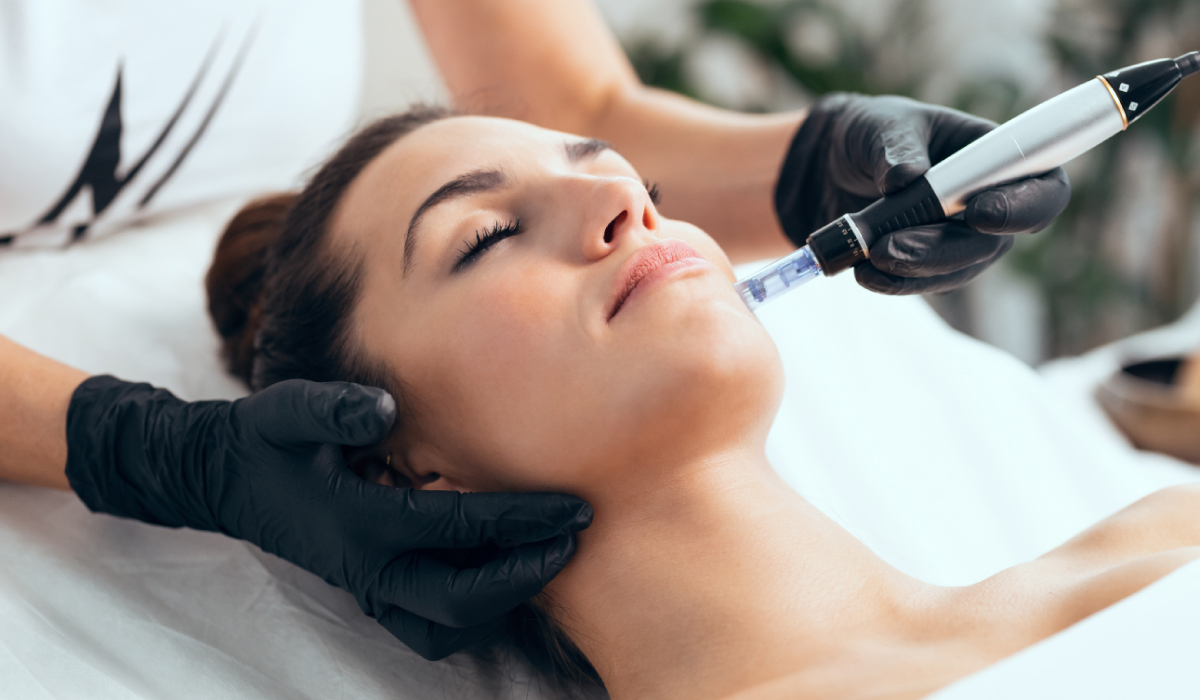 Microneedling